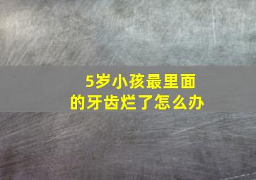 5岁小孩最里面的牙齿烂了怎么办