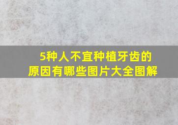 5种人不宜种植牙齿的原因有哪些图片大全图解