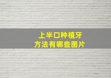 上半口种植牙方法有哪些图片