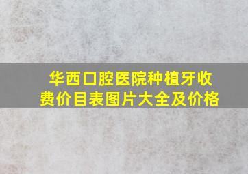 华西口腔医院种植牙收费价目表图片大全及价格