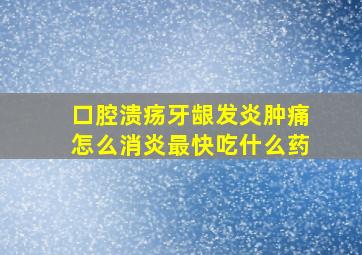 口腔溃疡牙龈发炎肿痛怎么消炎最快吃什么药