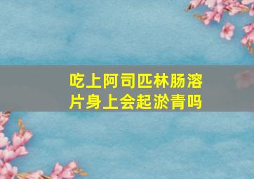 吃上阿司匹林肠溶片身上会起淤青吗