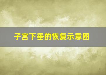 子宫下垂的恢复示意图