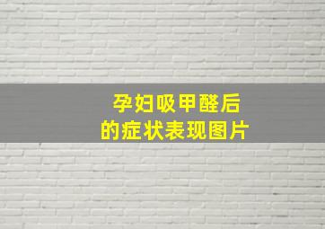 孕妇吸甲醛后的症状表现图片