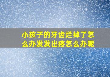 小孩子的牙齿烂掉了怎么办发发出疼怎么办呢