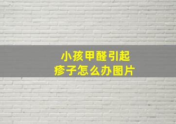 小孩甲醛引起疹子怎么办图片