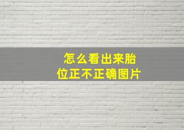 怎么看出来胎位正不正确图片