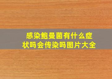 感染鲍曼菌有什么症状吗会传染吗图片大全