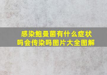 感染鲍曼菌有什么症状吗会传染吗图片大全图解