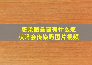 感染鲍曼菌有什么症状吗会传染吗图片视频