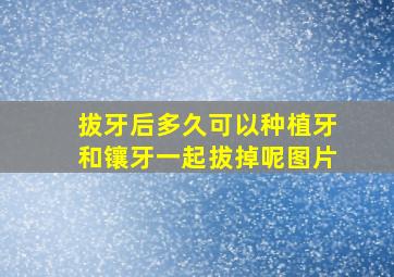 拔牙后多久可以种植牙和镶牙一起拔掉呢图片