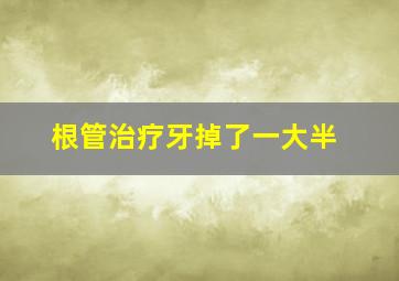 根管治疗牙掉了一大半