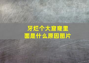 牙烂个大窟窿里面是什么原因图片