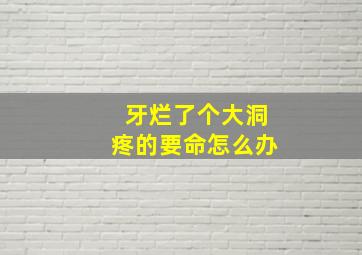 牙烂了个大洞疼的要命怎么办