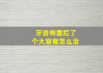 牙齿侧面烂了个大窟窿怎么治