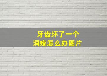 牙齿坏了一个洞疼怎么办图片