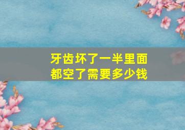 牙齿坏了一半里面都空了需要多少钱