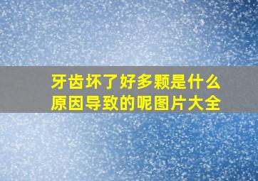 牙齿坏了好多颗是什么原因导致的呢图片大全