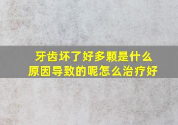 牙齿坏了好多颗是什么原因导致的呢怎么治疗好