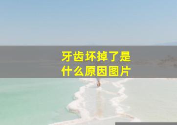 牙齿坏掉了是什么原因图片