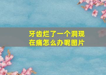 牙齿烂了一个洞现在痛怎么办呢图片