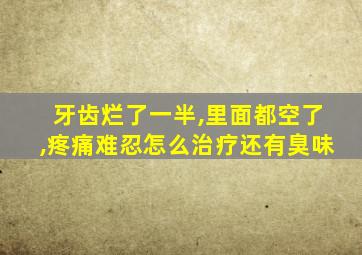 牙齿烂了一半,里面都空了,疼痛难忍怎么治疗还有臭味