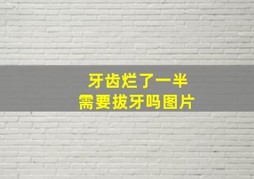 牙齿烂了一半需要拔牙吗图片