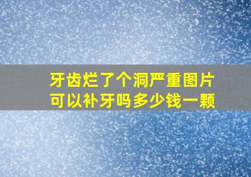 牙齿烂了个洞严重图片可以补牙吗多少钱一颗