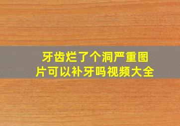 牙齿烂了个洞严重图片可以补牙吗视频大全