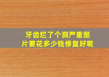 牙齿烂了个洞严重图片要花多少钱修复好呢