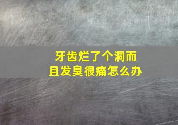 牙齿烂了个洞而且发臭很痛怎么办