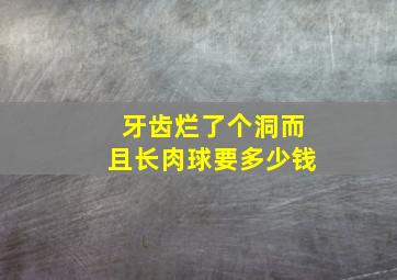 牙齿烂了个洞而且长肉球要多少钱