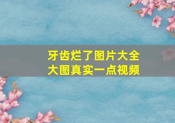 牙齿烂了图片大全大图真实一点视频