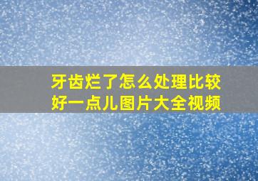 牙齿烂了怎么处理比较好一点儿图片大全视频