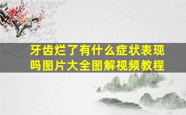 牙齿烂了有什么症状表现吗图片大全图解视频教程