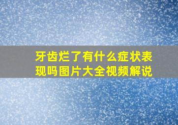 牙齿烂了有什么症状表现吗图片大全视频解说