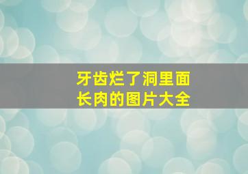 牙齿烂了洞里面长肉的图片大全