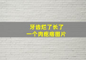 牙齿烂了长了一个肉疙瘩图片