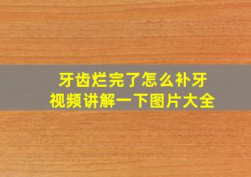 牙齿烂完了怎么补牙视频讲解一下图片大全