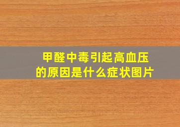 甲醛中毒引起高血压的原因是什么症状图片