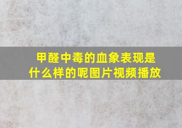 甲醛中毒的血象表现是什么样的呢图片视频播放