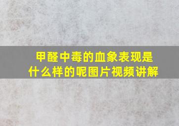 甲醛中毒的血象表现是什么样的呢图片视频讲解