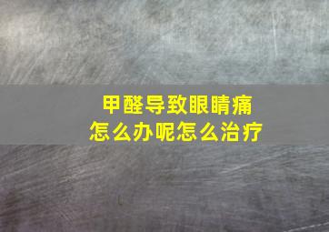 甲醛导致眼睛痛怎么办呢怎么治疗