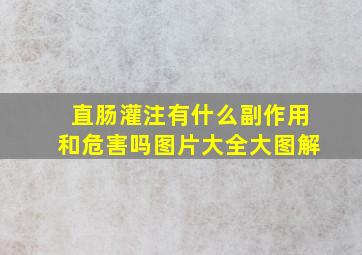 直肠灌注有什么副作用和危害吗图片大全大图解