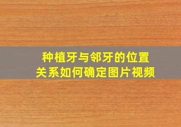 种植牙与邻牙的位置关系如何确定图片视频