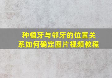 种植牙与邻牙的位置关系如何确定图片视频教程