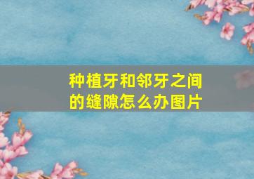 种植牙和邻牙之间的缝隙怎么办图片