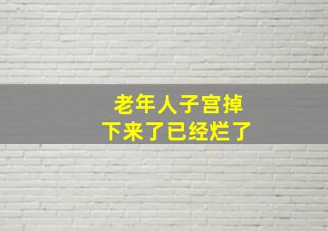 老年人子宫掉下来了已经烂了