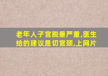 老年人子宫脱垂严重,医生给的建议是切宫颈,上网片