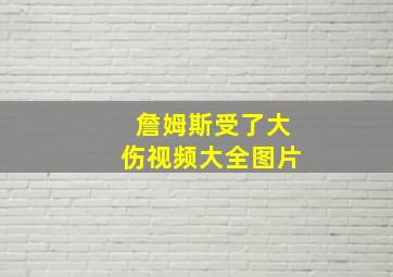 詹姆斯受了大伤视频大全图片